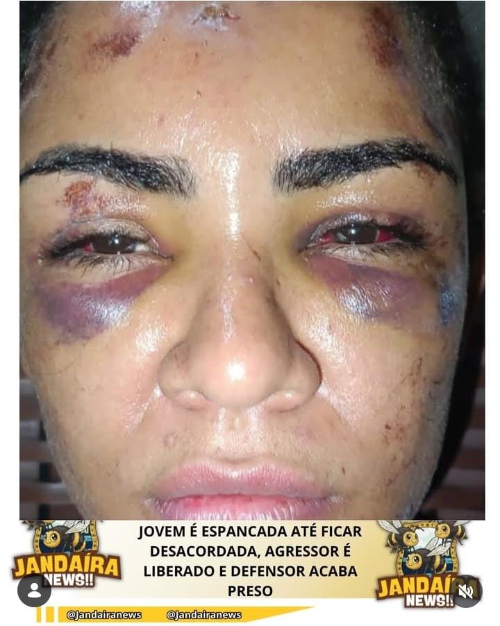 NA MANHÃ DESTE DOMINGO, 25/01/2026, CHEGARAM À NOSSA REDAÇÃO FOTOS E UMA GRAVE DENÚNCIA ENVOLVENDO UMA JOVEM QUE FOI BRUTALMENTE ESPANCADA E POR POUCO